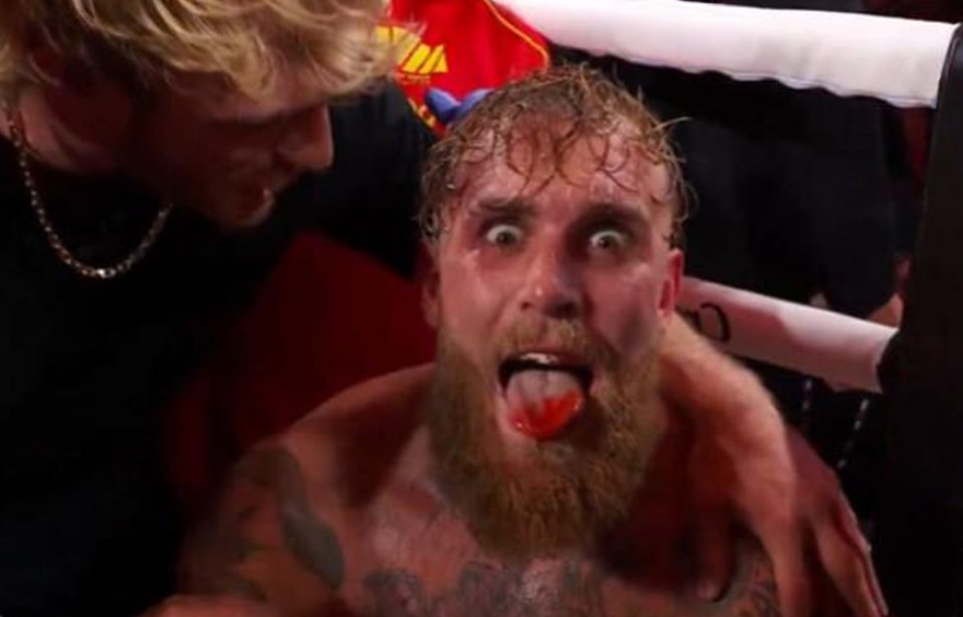 «Моя челюсть сломана». Джейк Пол — о последствиях боя с Энтони Джошуа